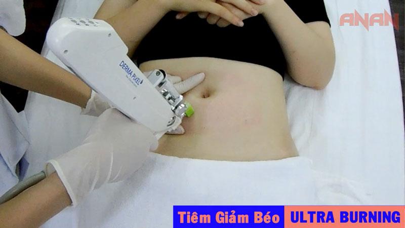 Tiêm-giảm-béo-công-nghệ-Ultra-Burning